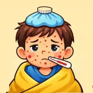 হাম উপসর্গে সাত জনের