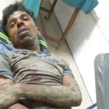 সাচিবুনিয়ায় যুবককে কুপিয়ে জখম