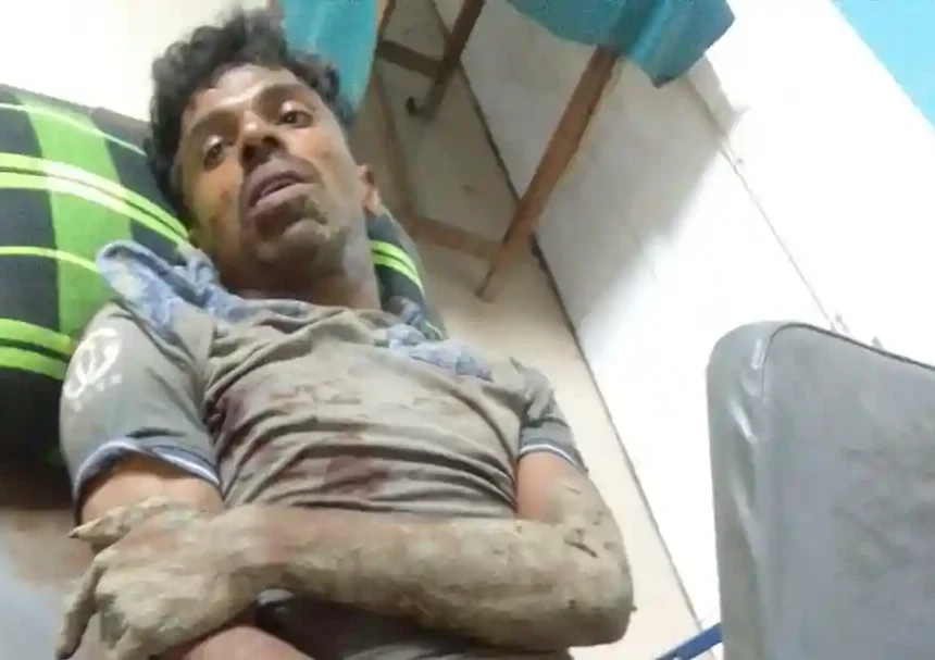 সাচিবুনিয়ায় যুবককে কুপিয়ে জখম