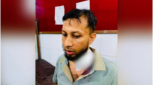 আড়াইহাজারে এসিল্যান্ডের ওপর হামলা: কুপিয়ে জখম-৬