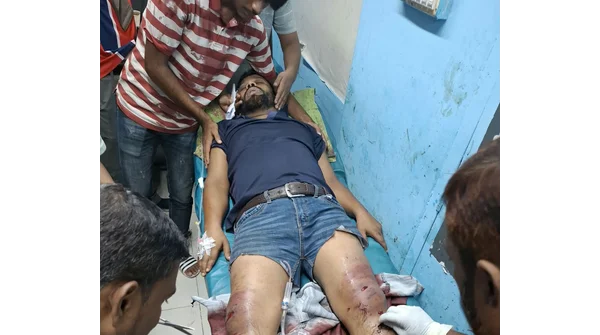 রিপন আকন আহত: রূপসায় ধারালো অস্ত্রের হামলা